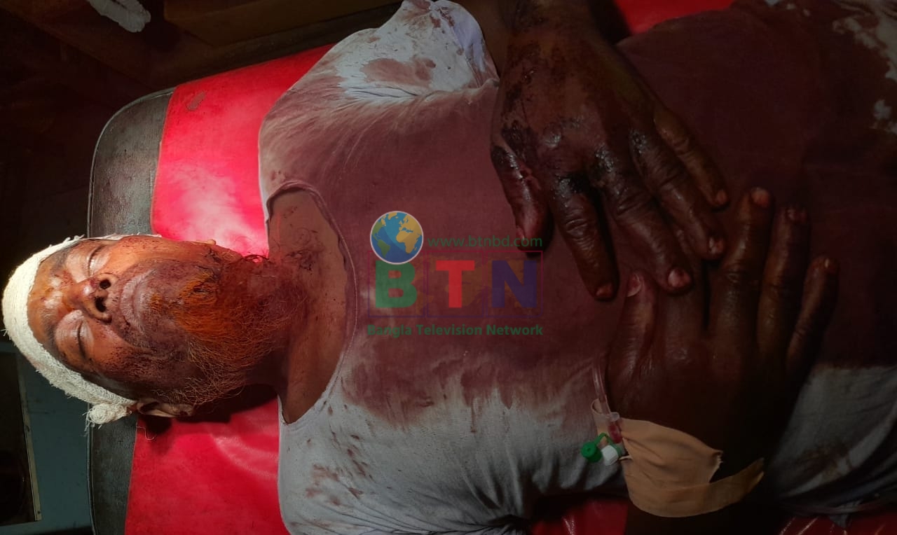 বগুড়ার শেরপুরে আদিবাসী পরিবারের মালিকানাধীন পুকুর দখলের চেষ্টা আহত ১ জন